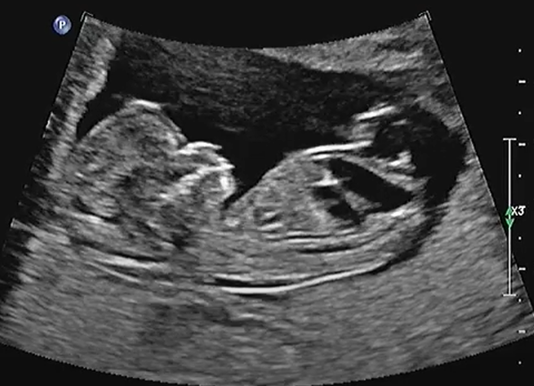 MRI Image Preview