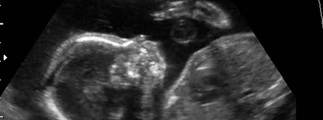 MRI Image Preview