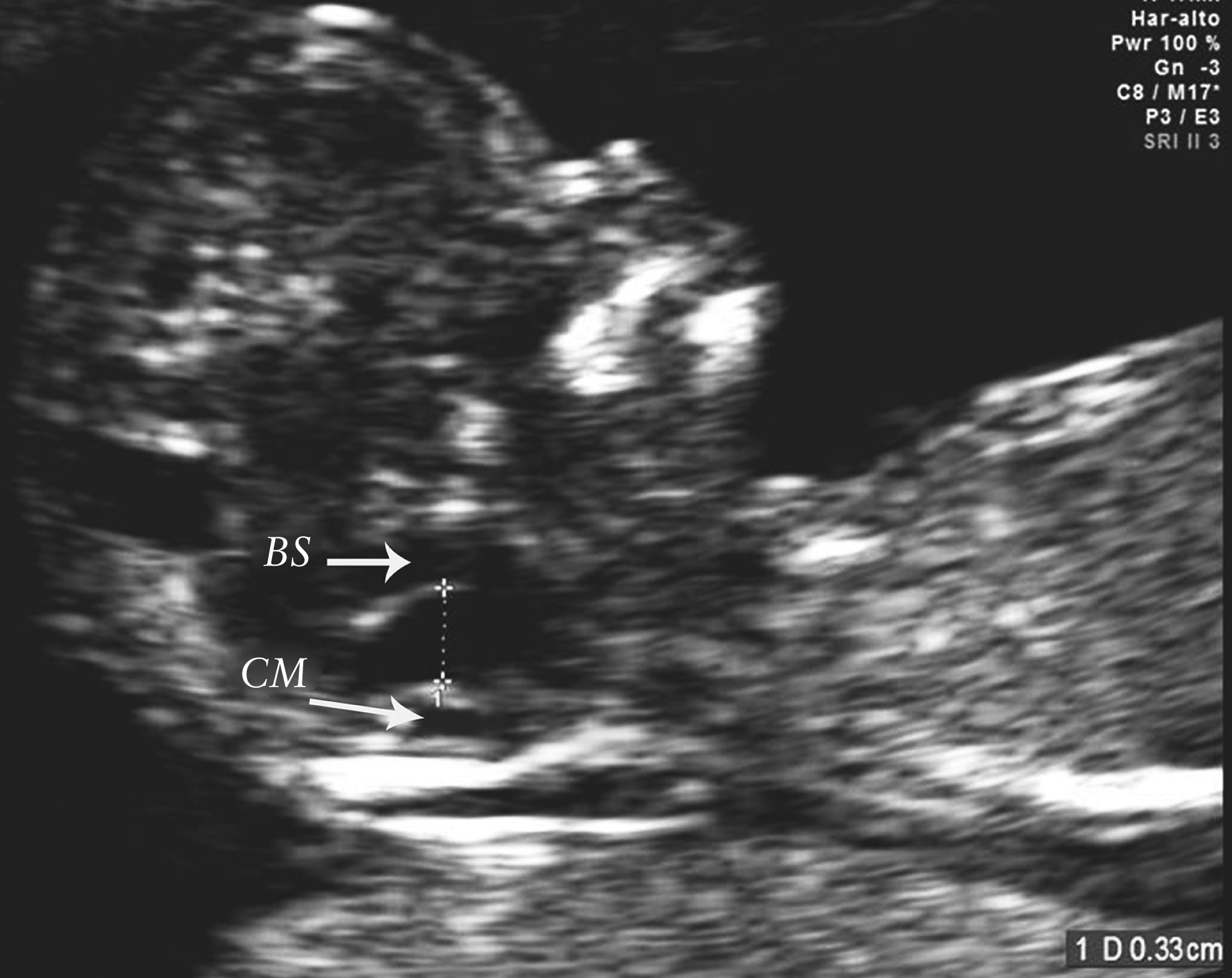 MRI Image Preview