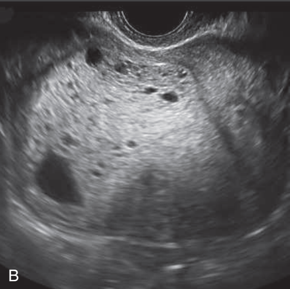 MRI Image Preview
