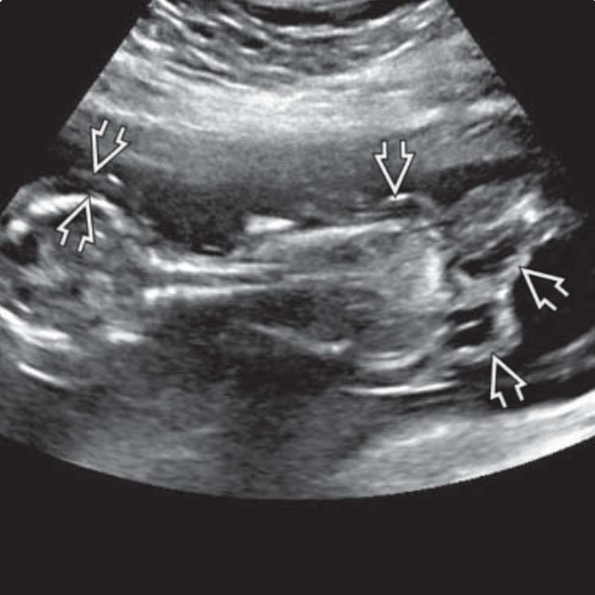 MRI Image Preview