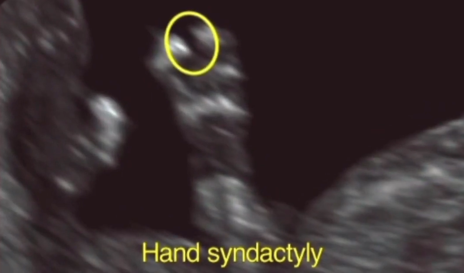 MRI Image Preview