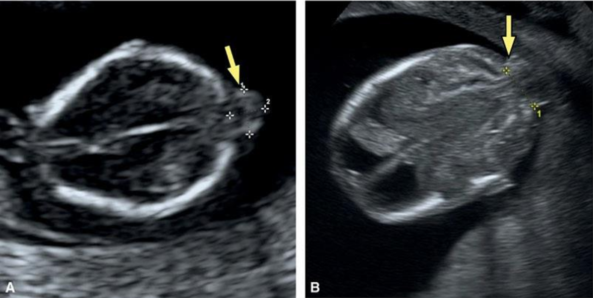 MRI Image Preview
