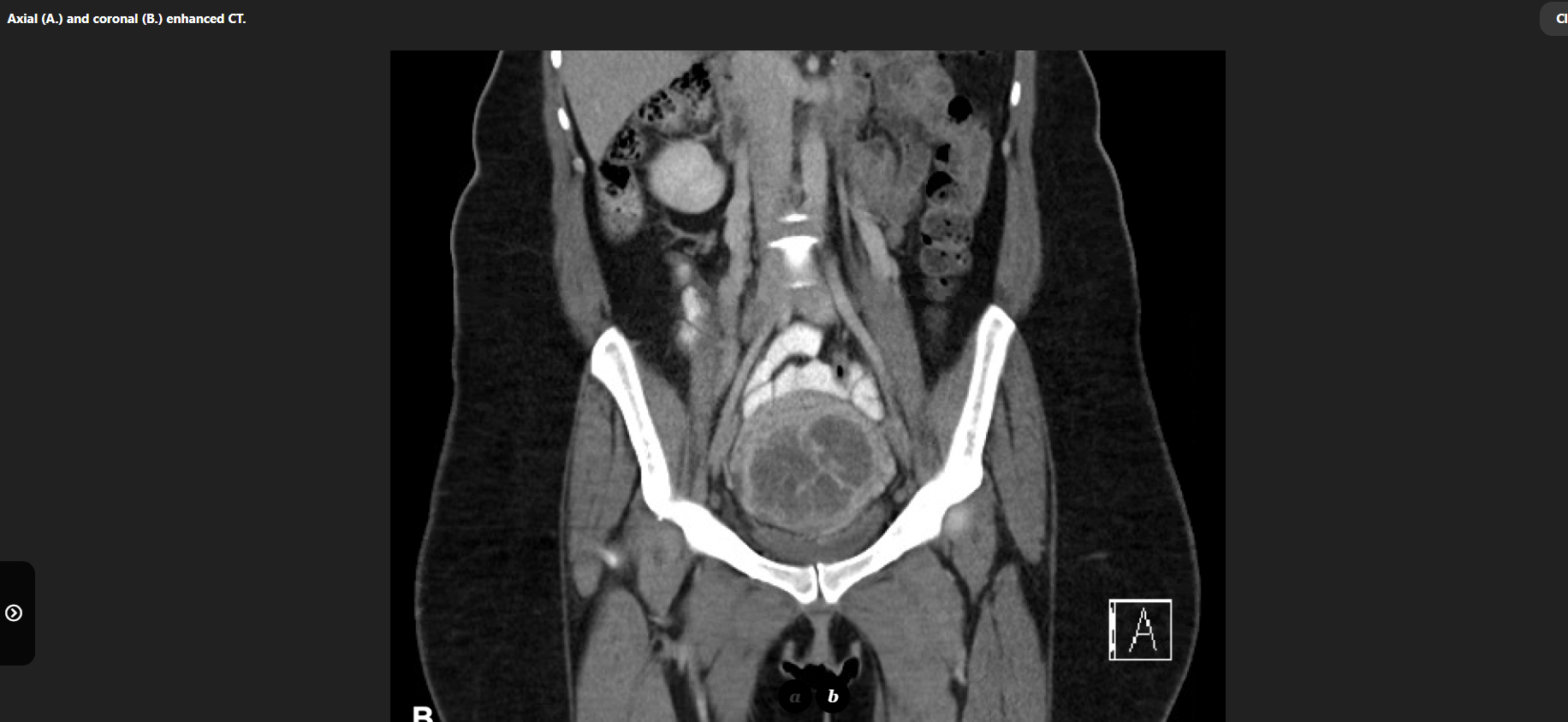 MRI Image Preview
