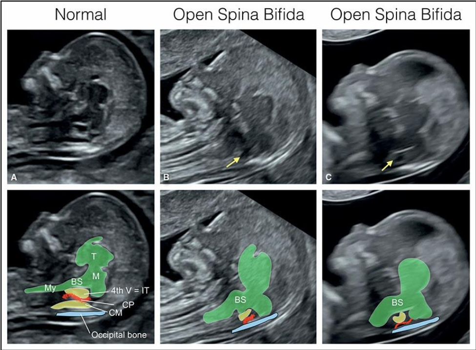 MRI Image Preview