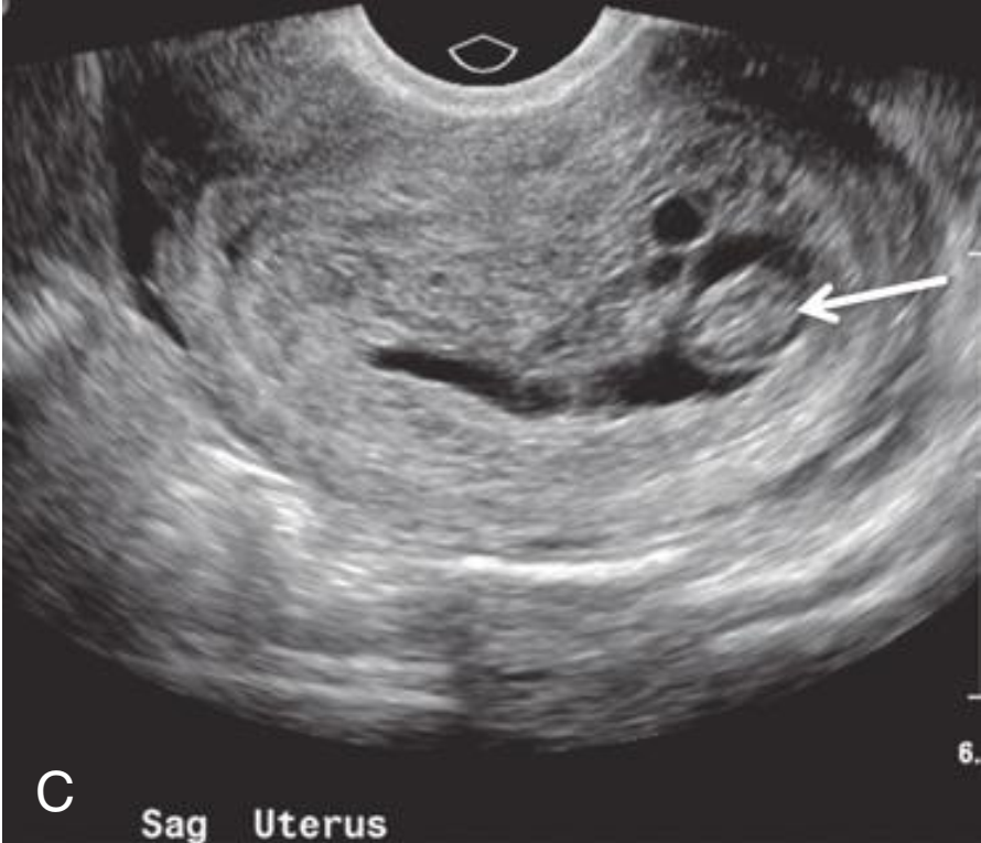 MRI Image Preview