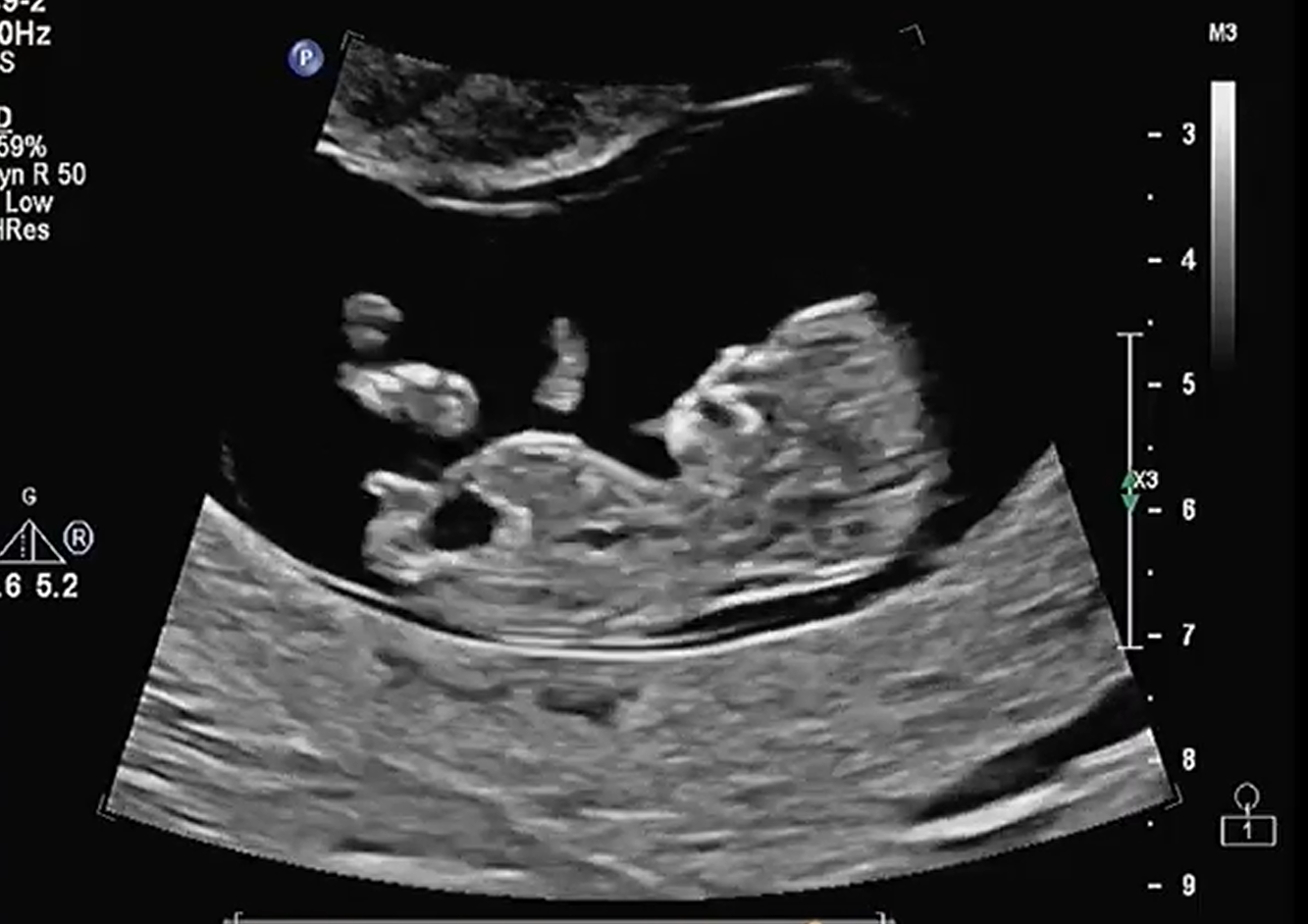 MRI Image Preview
