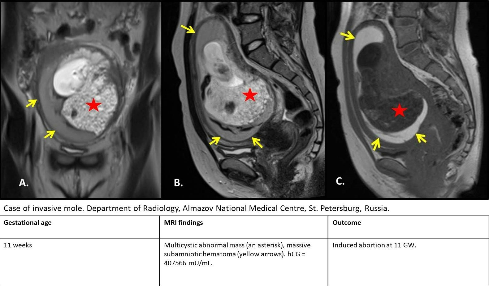 MRI Image Preview
