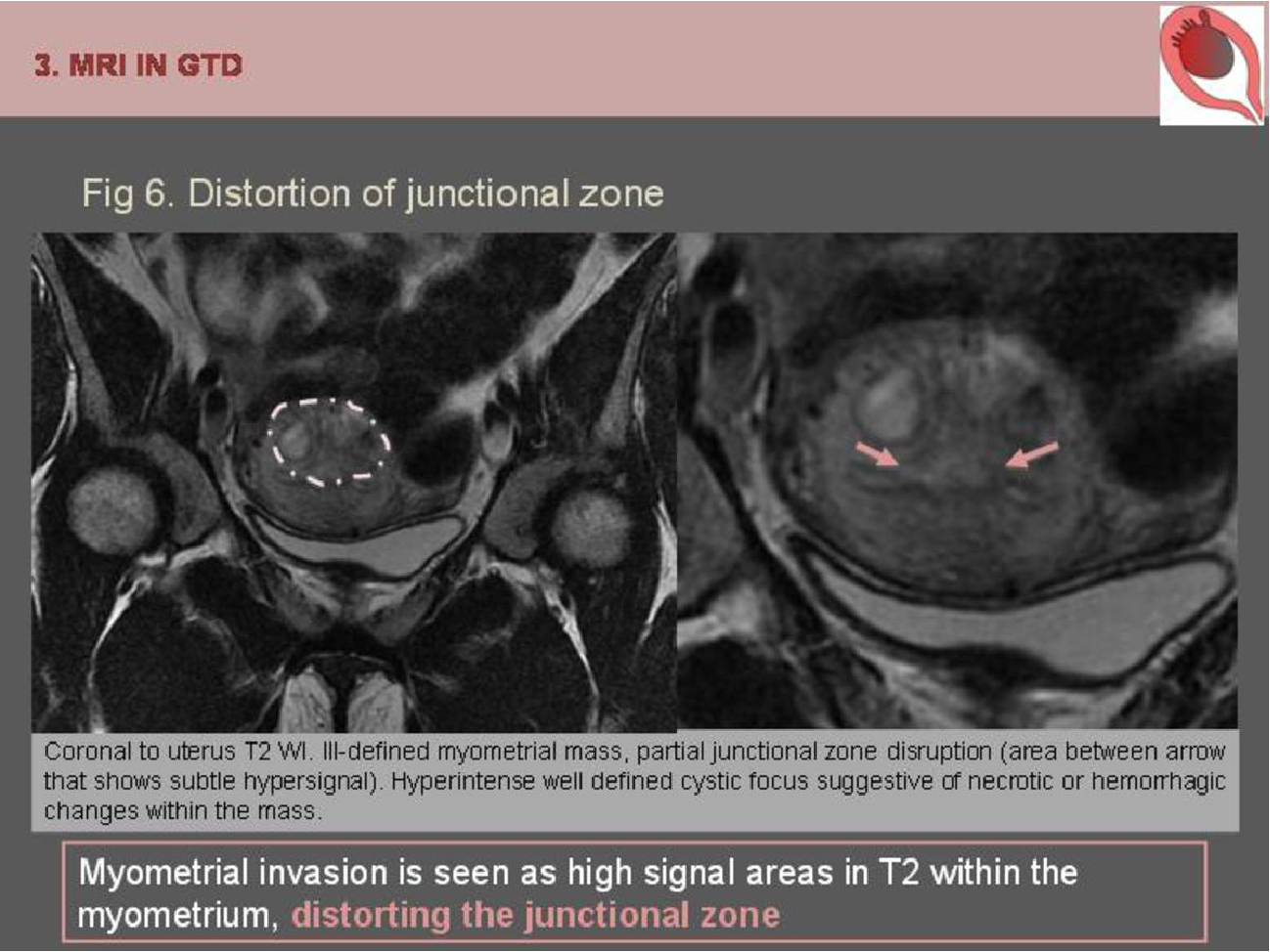 MRI Image Preview