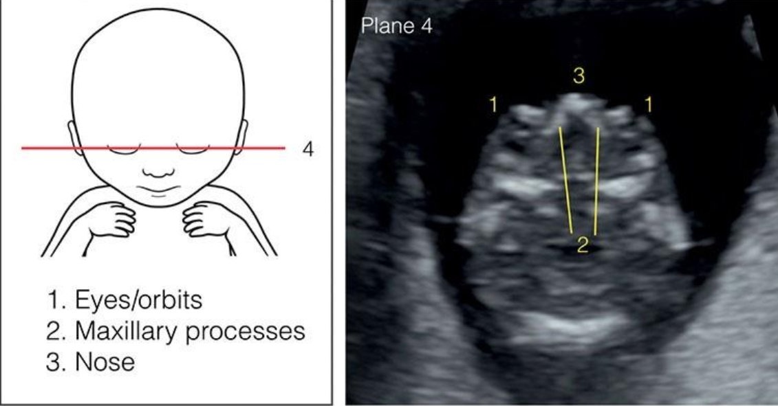 MRI Image Preview