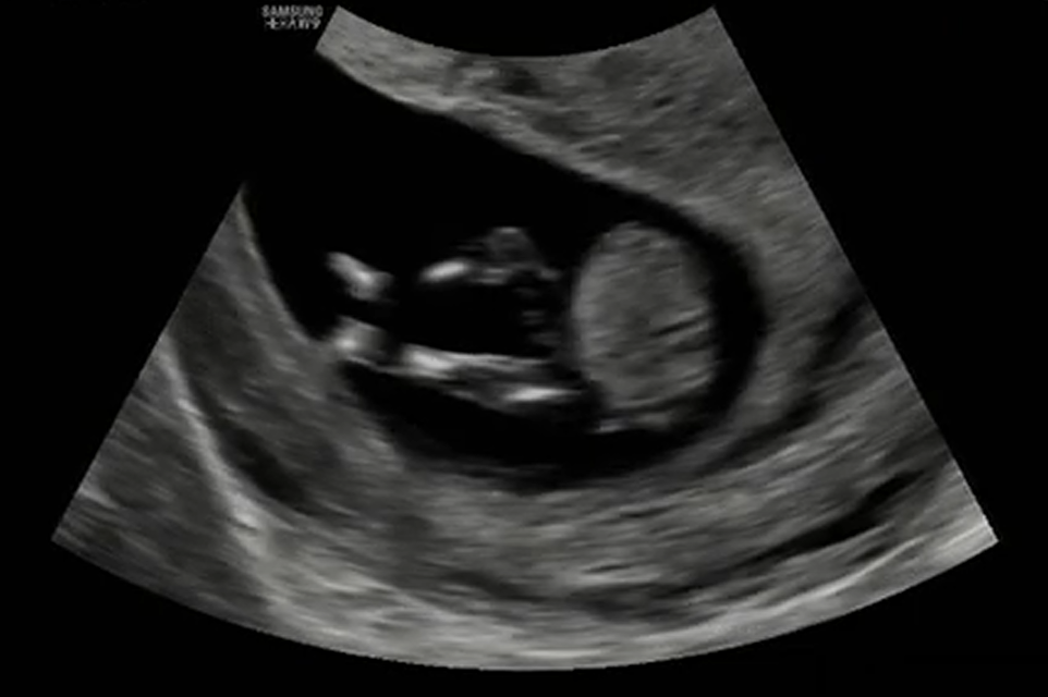MRI Image Preview