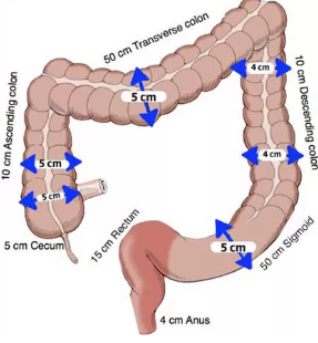 Giả tắc nghẽn đại tràng (Ogilvie syndrome (Colonic pseudo-obstruction))
