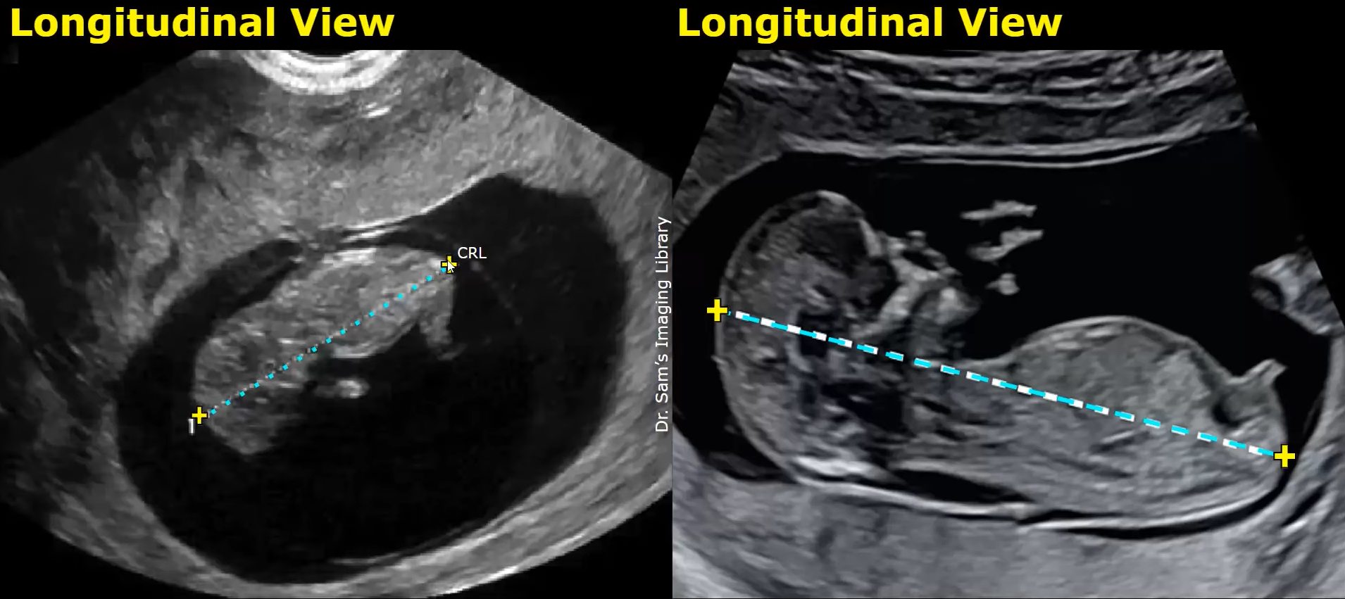 MRI Image Preview