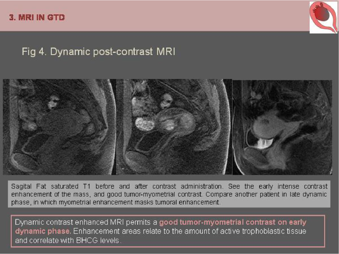 MRI Image Preview