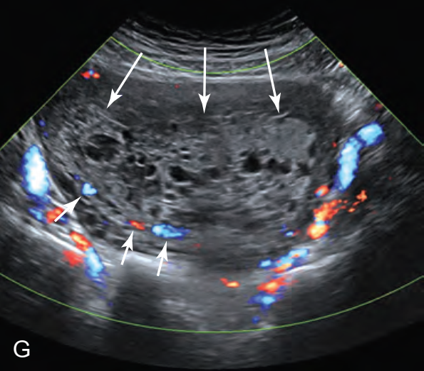MRI Image Preview