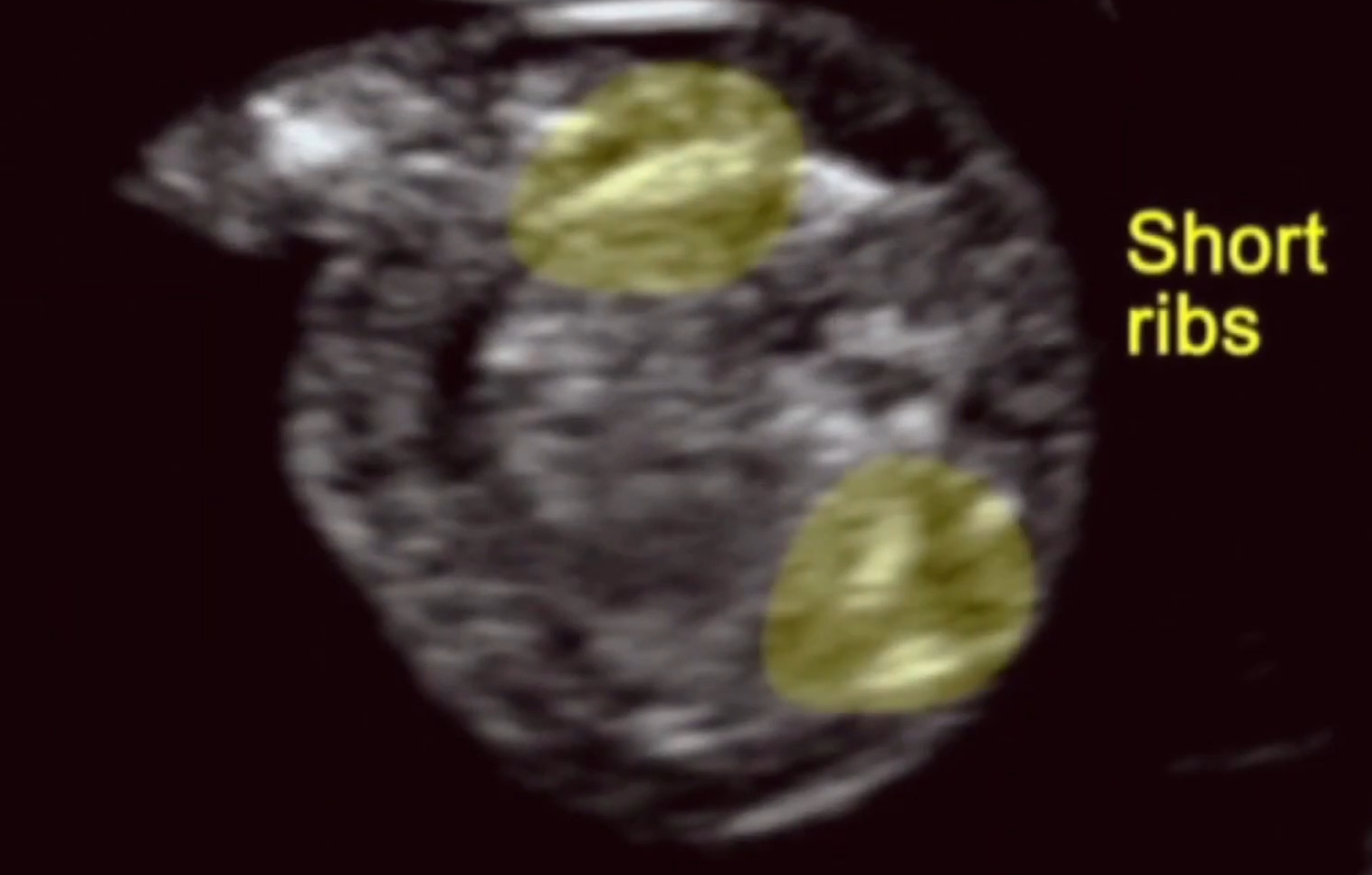 MRI Image Preview
