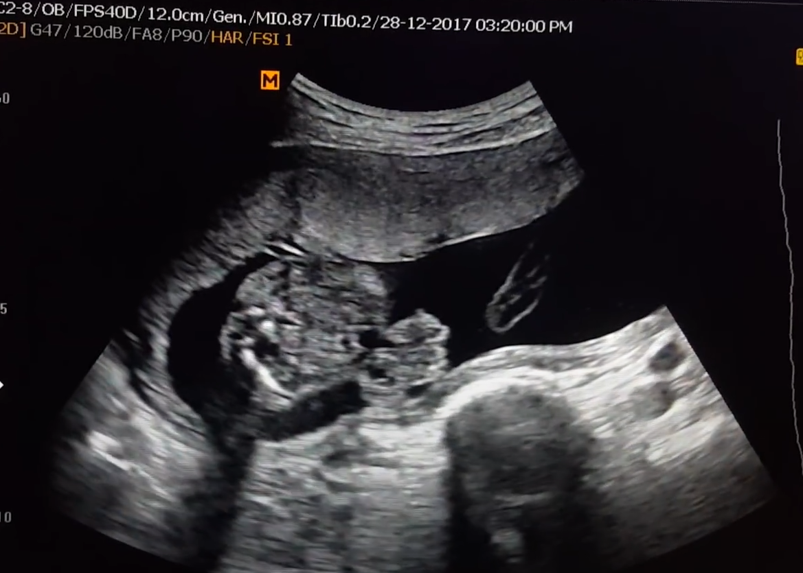 MRI Image Preview