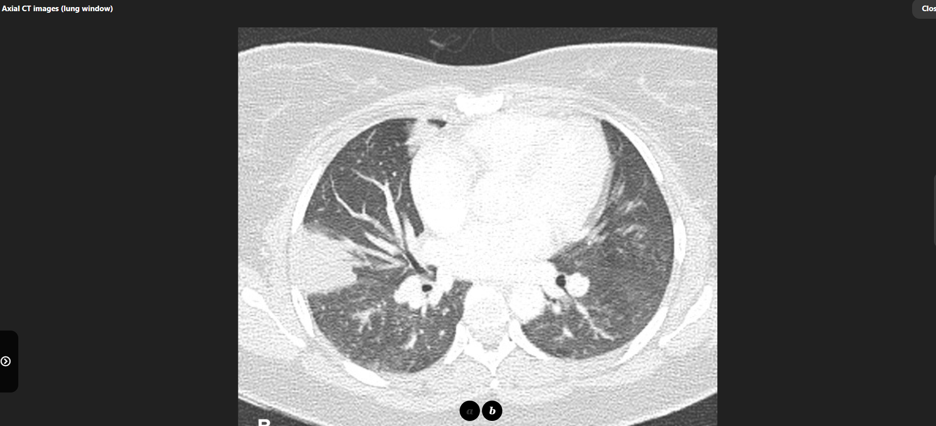 MRI Image Preview
