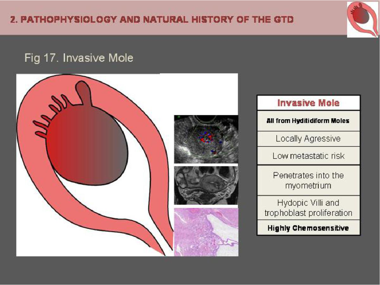 MRI Image Preview