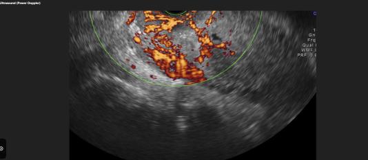 MRI Image Preview