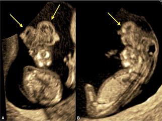 MRI Image Preview