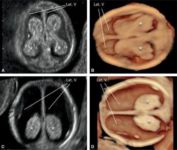 MRI Image Preview