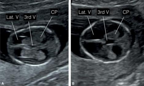 MRI Image Preview