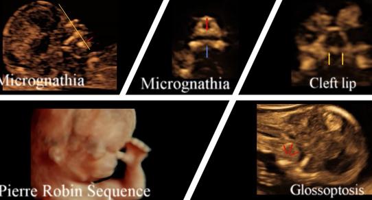 MRI Image Preview