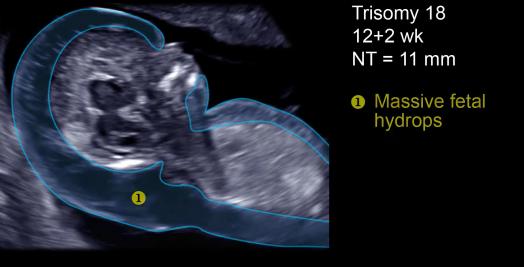 MRI Image Preview