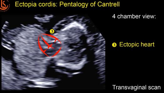 MRI Image Preview