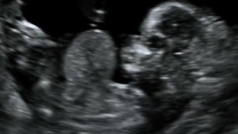 MRI Image Preview