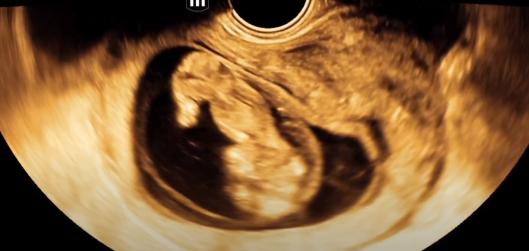 MRI Image Preview