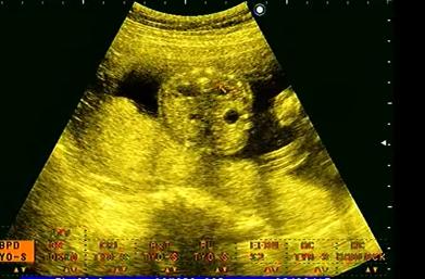 MRI Image Preview