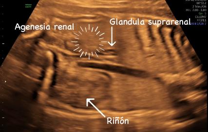 MRI Image Preview