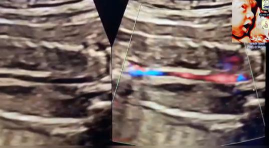 MRI Image Preview