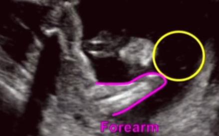 MRI Image Preview