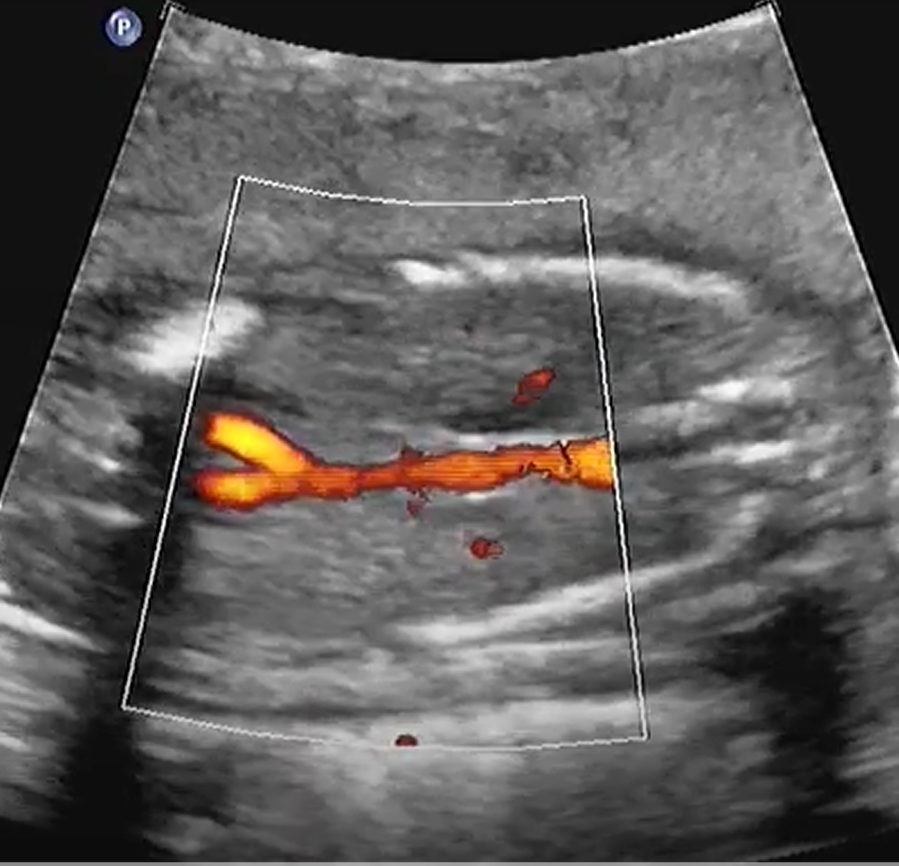 MRI Image Preview