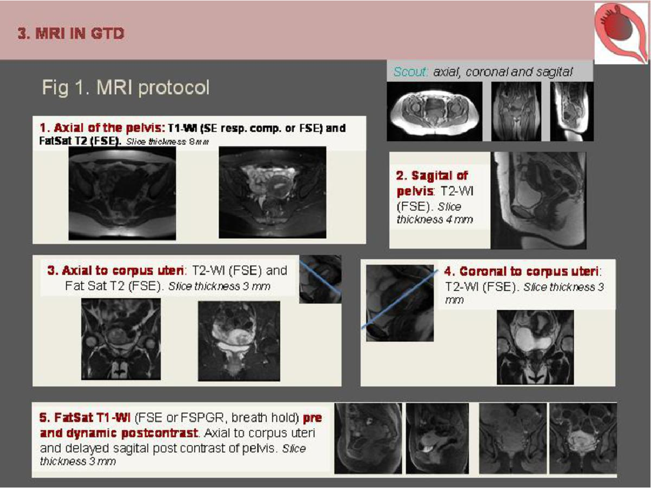 MRI Image Preview