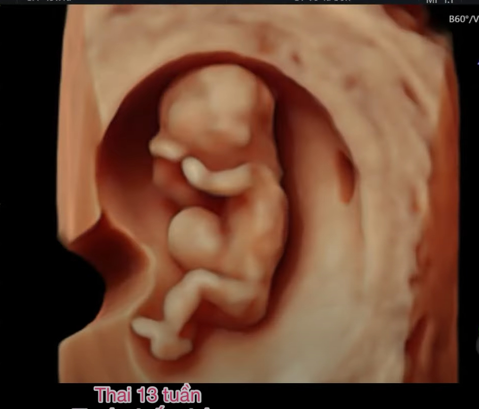 MRI Image Preview
