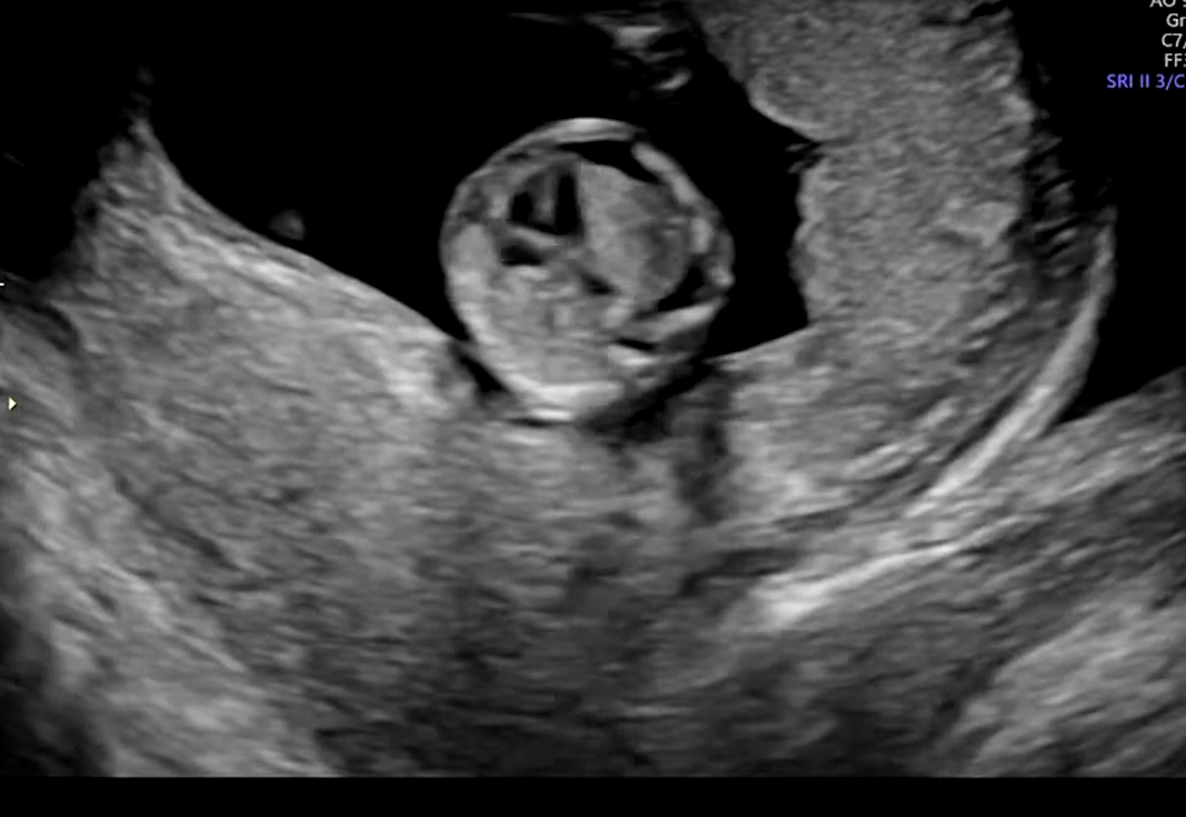 MRI Image Preview