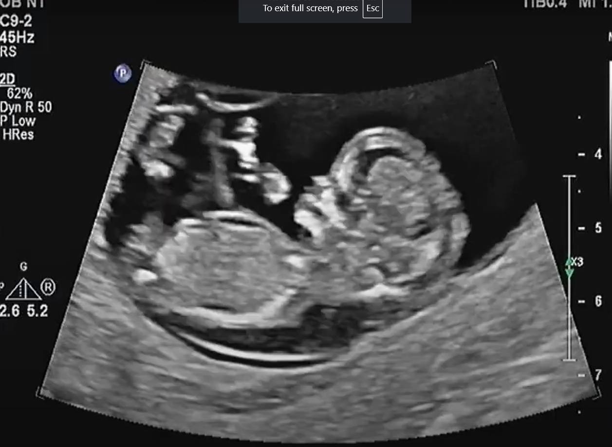 MRI Image Preview