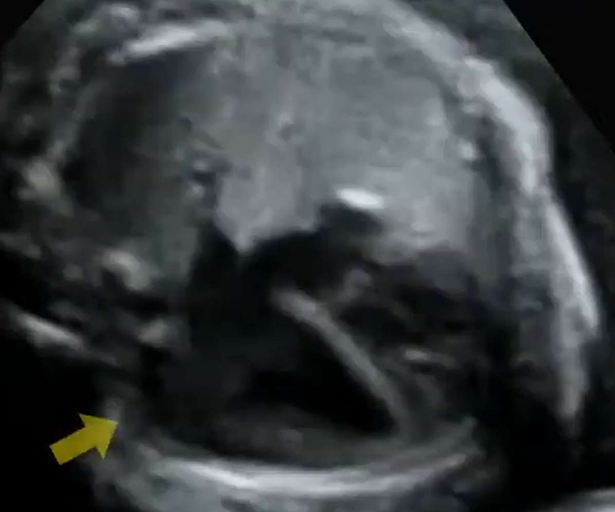 MRI Image Preview