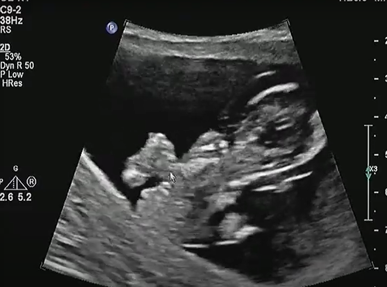 MRI Image Preview