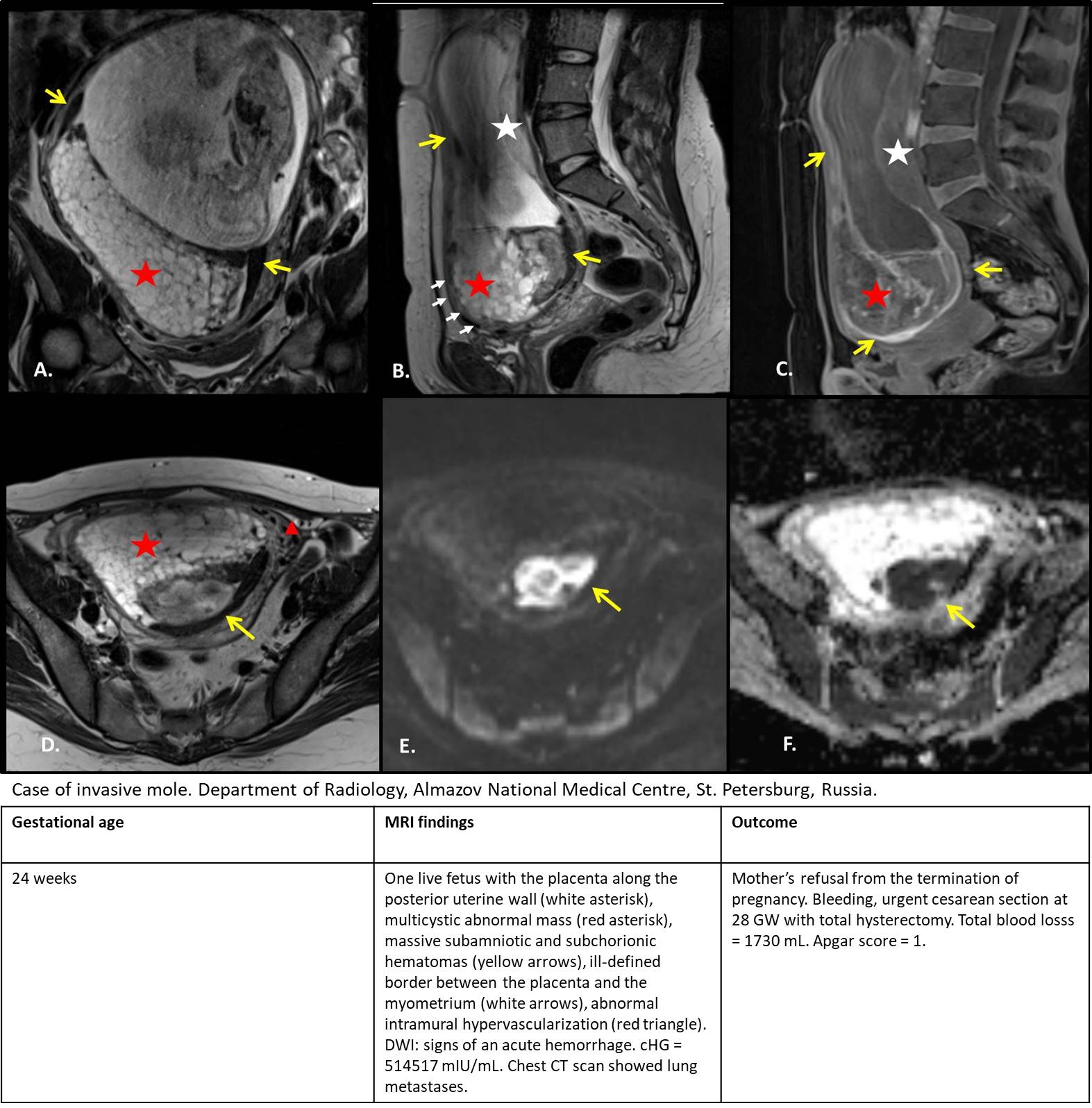 MRI Image Preview