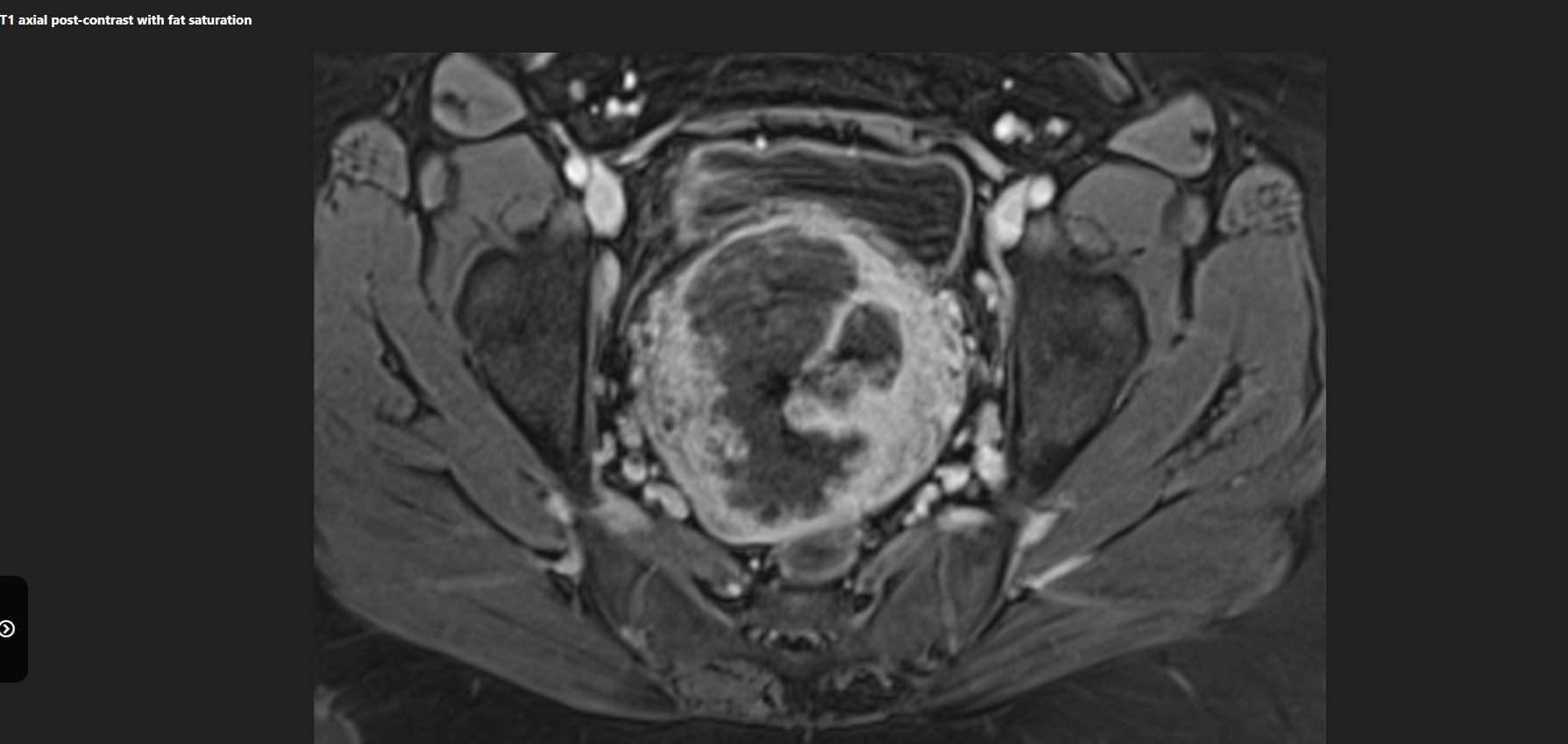 MRI Image Preview