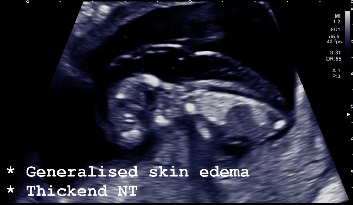 MRI Image Preview