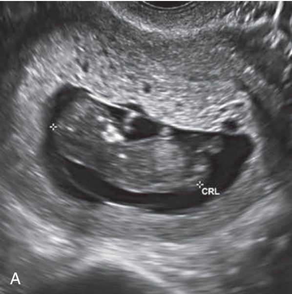MRI Image Preview