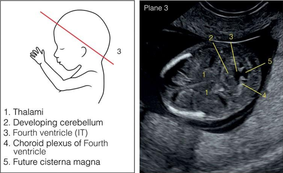 MRI Image Preview