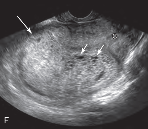 MRI Image Preview