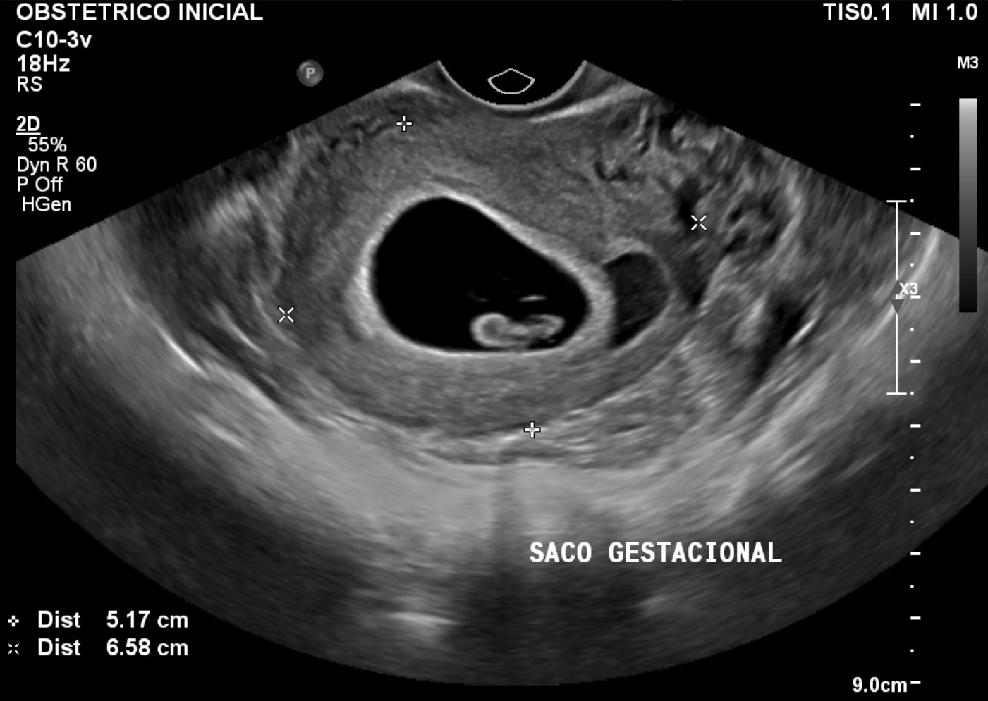 MRI Image Preview